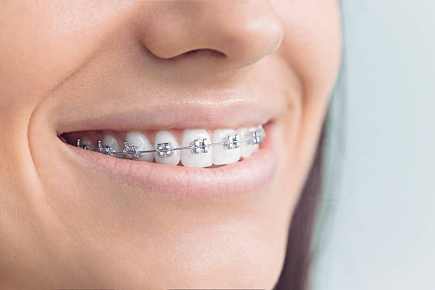 Best Invisalign and Clear Aligners  in Georgetown, PA